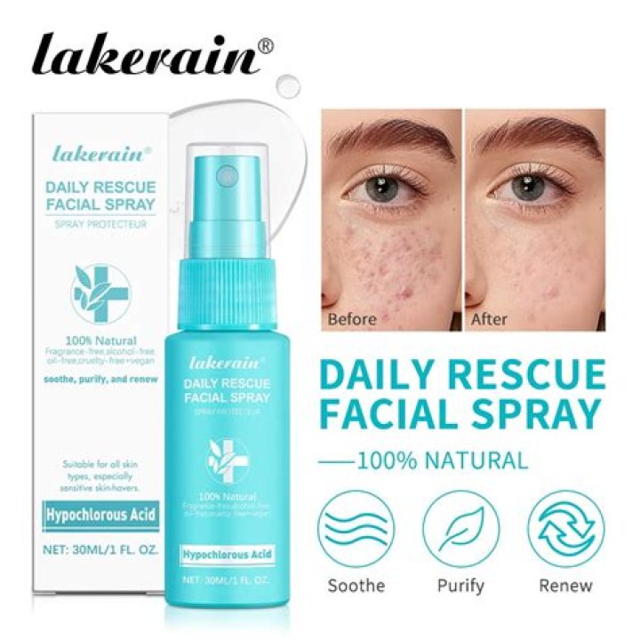 Dua Lipa Relies on This Facial Spray for the Ultimate ‘Glow Boost’
