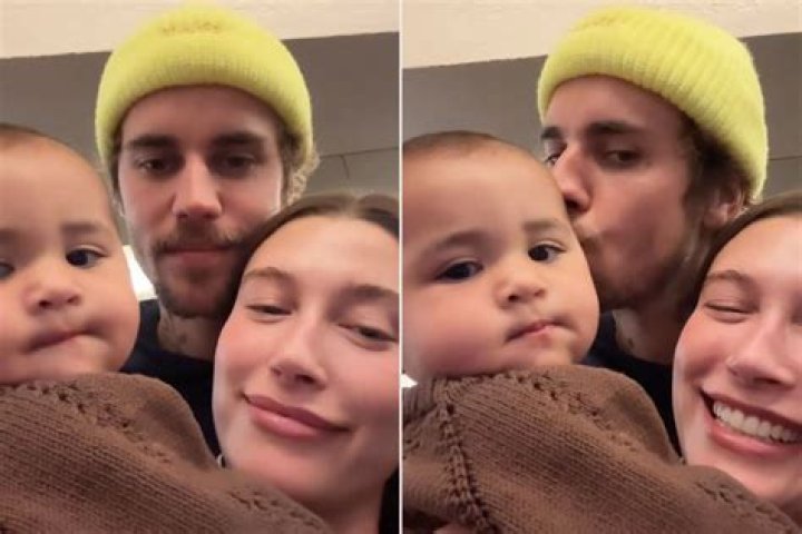 Hailey Bieber Shows Support For Justin After He Revealed Ramsay Hunt Syndrome: ‘I Love U Baby’