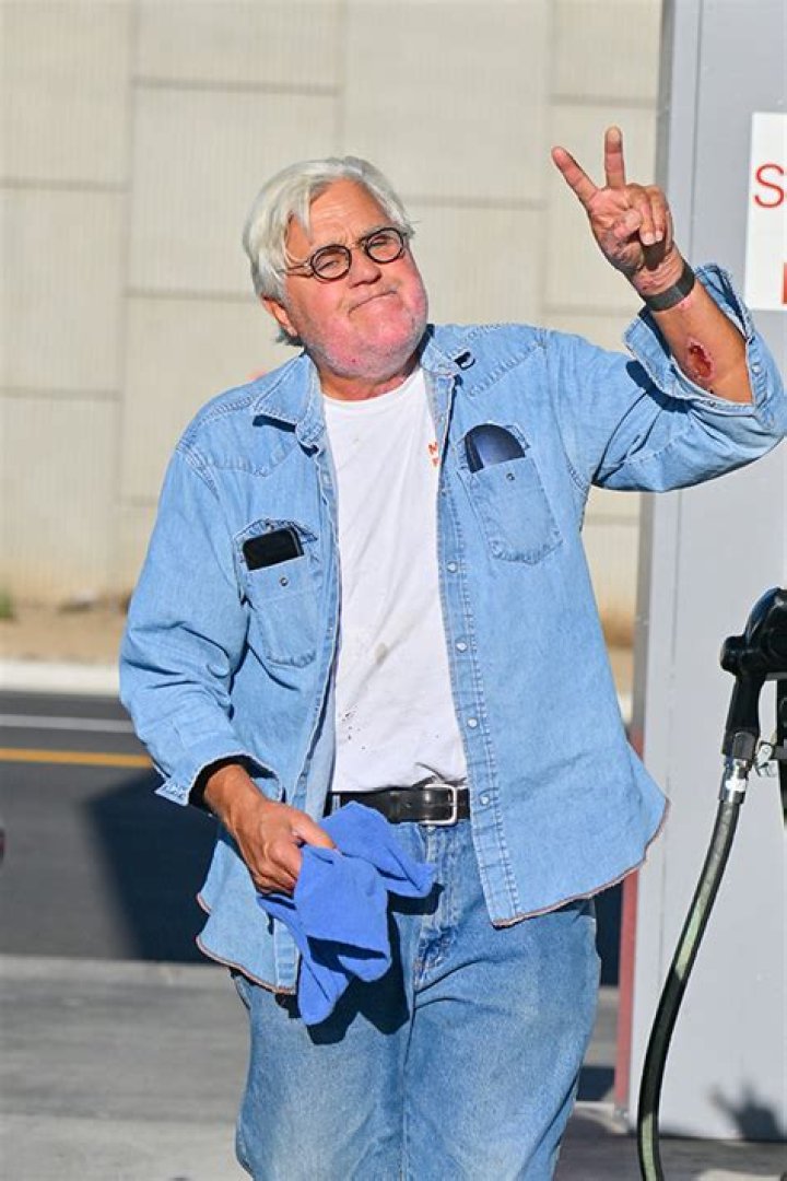 Jay Leno Jokes About His ‘New’ Face In 1st Interview Since Accident – Hollywood Life
