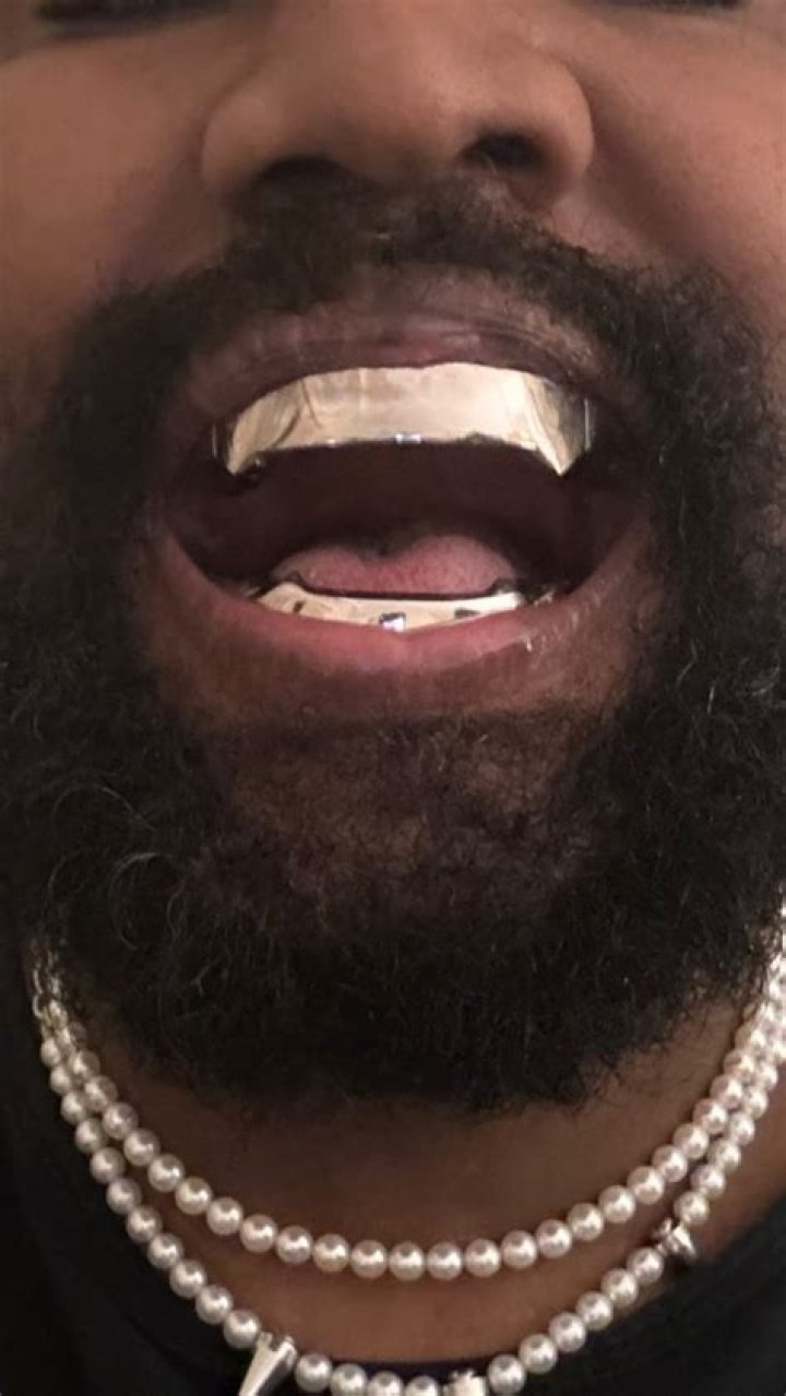 Kanye West Replaces His Teeth With Full Set of $850k Permanent Titanium Teeth