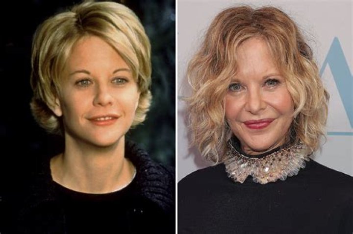 Not Plastic Surgery – Hollywood Life
