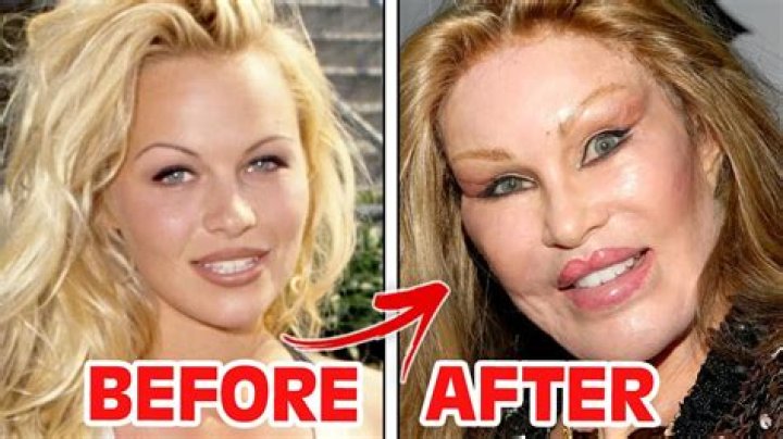 Plastic Surgery Should Wait — No Tummy Tuck After Baby – Hollywood Life