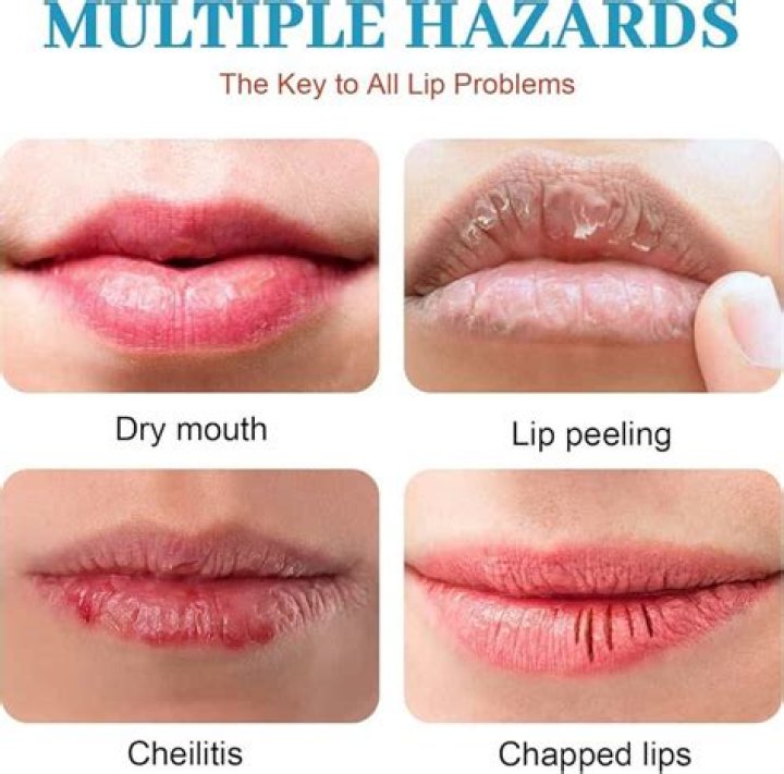 Reese Witherspoon Swears by This Lip Balm for Chapped Lips