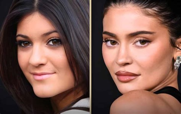 See Before & After Pics Of Kylie Jenner & More – Hollywood Life