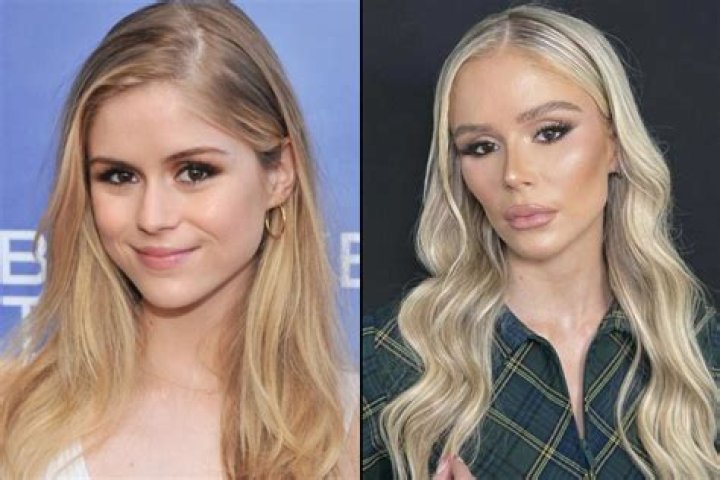 Shows Off Recent Surgery – Hollywood Life