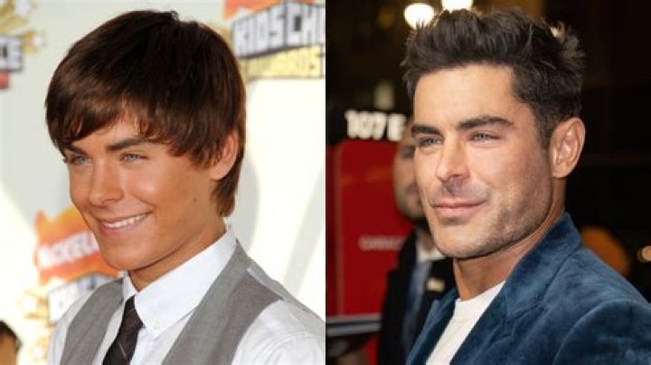 Zac Efron’s Jaw Wired Shut After Bizarre Sex Accident, Friends Claim